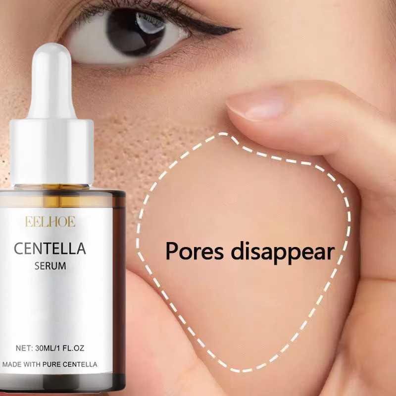 Luxury Skincare Brands - Centella Asiatica Face Serum Nourish Dry